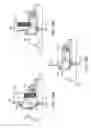 Fig. 85 - SYSTEM FOR TENSIONING A SURGICAL CLOSURE