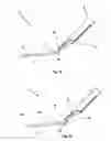 Fig. 08 - Access and Closure Device and Method