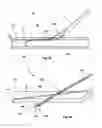 Fig. 33 - Access and Closure Device and Method