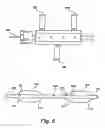Fig. 08 - PARTIAL AORTIC OCCLUSION DEVICES AND METHODS FOR CEREBRAL PERFUSION AUGMENTATION
