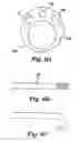Fig. 09 - PARTIAL AORTIC OCCLUSION DEVICES AND METHODS FOR CEREBRAL PERFUSION AUGMENTATION