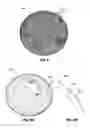 Fig. 04 - INTRAGASTRIC BALLOON GEOMETRIES