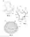 Fig. 07 - RE-SHAPING INTRAGASTRIC IMPLANTS