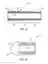 Fig. 06 - Vaso-occlusive device