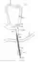 Fig. 01 - Method for providing surgical access