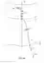 Fig. 25 - Method for providing surgical access