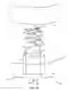 Fig. 28 - Method for providing surgical access