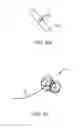 Fig. 32 - Method for providing surgical access