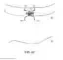 Fig. 35 - Method for providing surgical access