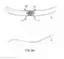 Fig. 37 - Method for providing surgical access