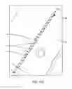 Fig. 41 - Method for providing surgical access