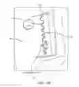 Fig. 44 - Method for providing surgical access