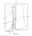 Fig. 45 - Method for providing surgical access