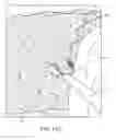 Fig. 52 - Method for providing surgical access