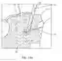 Fig. 53 - Method for providing surgical access