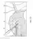 Fig. 55 - Method for providing surgical access