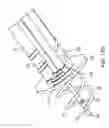 Fig. 71 - Method for providing surgical access