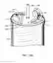 Fig. 78 - Method for providing surgical access