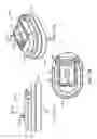 Fig. 84 - Method for providing surgical access