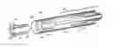 Fig. 01 - Suture lock fastening device
