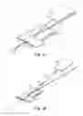 Fig. 09 - Suture lock fastening device