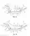 Fig. 02 - SPINAL TRACTION DEVICE