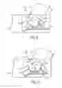 Fig. 07 - SPINAL TRACTION DEVICE