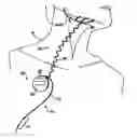 Fig. 01 - Obstructive sleep apnea treatment devices, systems and methods