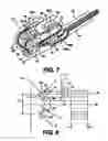 Fig. 06 - Obstructive sleep apnea treatment devices, systems and methods