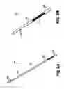 Fig. 07 - Obstructive sleep apnea treatment devices, systems and methods