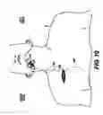 Fig. 08 - Obstructive sleep apnea treatment devices, systems and methods