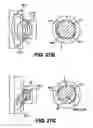 Fig. 22 - Obstructive sleep apnea treatment devices, systems and methods