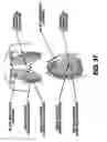 Fig. 33 - Obstructive sleep apnea treatment devices, systems and methods