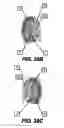 Fig. 35 - Obstructive sleep apnea treatment devices, systems and methods