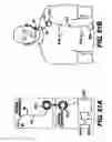 Fig. 43 - Obstructive sleep apnea treatment devices, systems and methods