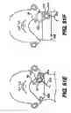 Fig. 45 - Obstructive sleep apnea treatment devices, systems and methods