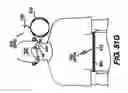 Fig. 46 - Obstructive sleep apnea treatment devices, systems and methods