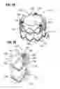 Fig. 09 - Spiraled commissure attachment for prosthetic valve