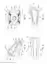 Fig. 02 - INTERVERTEBRAL IMPLANT AND TOOL FOR PLACING SAME