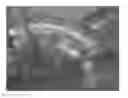 Fig. 01 - MEDICAL DEVICES WITH GALVANIC PARTICULATES