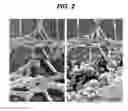 Fig. 03 - MEDICAL DEVICES WITH GALVANIC PARTICULATES