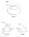 Fig. 84 - IMPLANT COMPONENTS AND METHODS