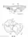 Fig. 92 - IMPLANT COMPONENTS AND METHODS