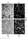 Fig. 02 - BIOMARKERS AND METHODS OF TREATMENT