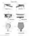 Fig. 06 - Portable feminine urinary device