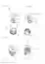 Fig. 03 - Fastening arrangement with tolerance compensation