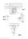 Fig. 02 - Supercharged Internal Combustion Engine