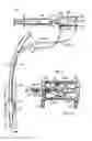 Fig. 02 - INFLATABLE RESPIRATORY CUFF WITH PRESSURE RELIEF VALVE