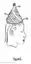 Fig. 06 - Method and kit for the multiple treatment of a head of hair