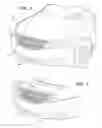 Fig. 02 - VENTILATION ASSEMBLY FOR A FRONT EXTERIOR OF A VEHICLE
